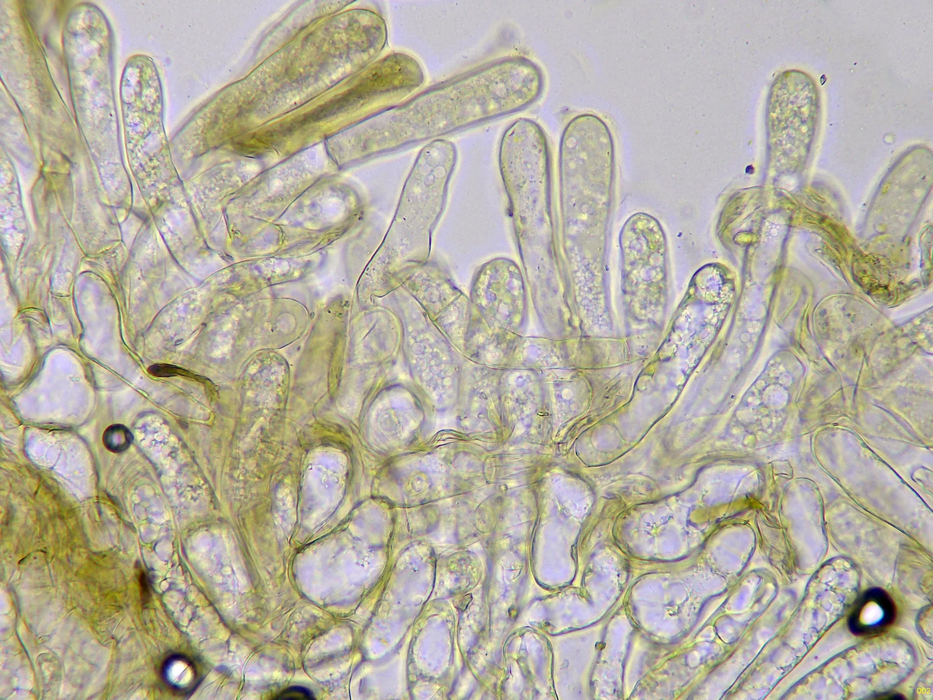 Microscopía de Morchella deliciosa - 10 - Ascos agua x 400-002